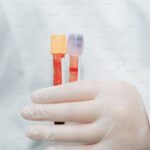 Blood work testing before starting supplements
