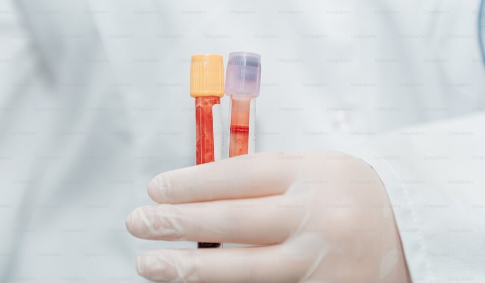 Blood work testing before starting supplements