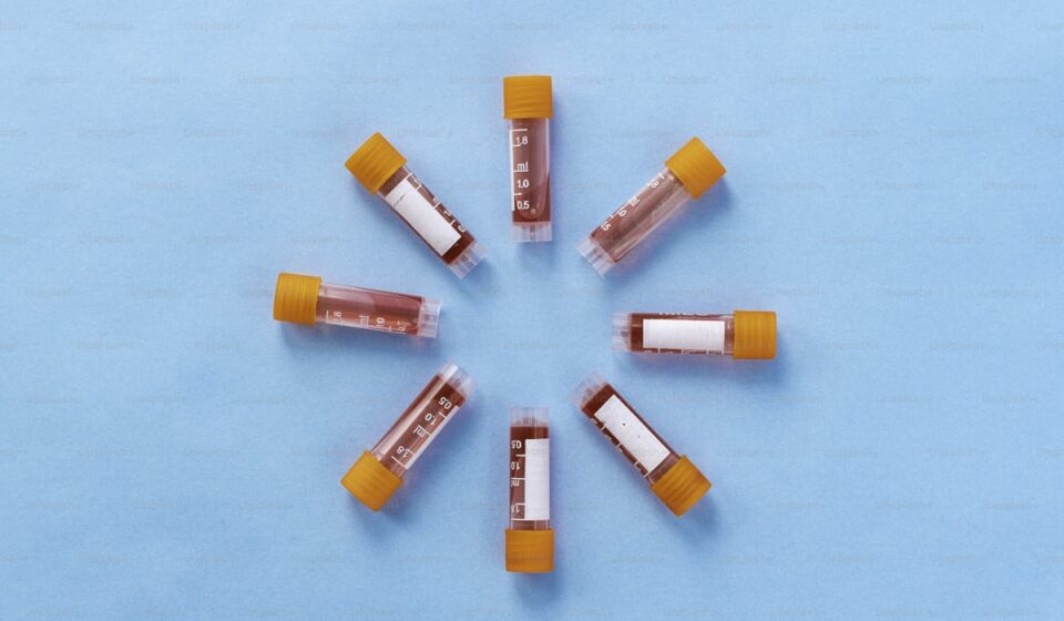 Blood test tubes and laboratory analysis for longevity health screening panels