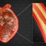 Supplements for lowering ApoB and heart health