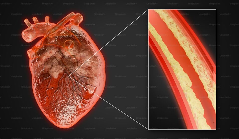 Supplements for lowering ApoB and heart health