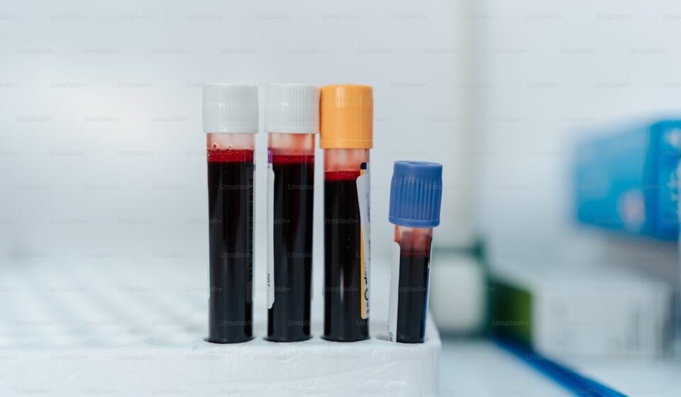 blood test tube for ApoB cardiovascular risk testing